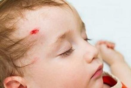 Wisconsin accident attorney, Wisconsin injury lawyer